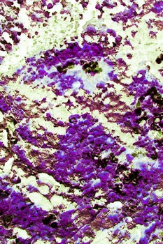 AP 67A1